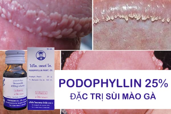 podophyllin 25 thuoc