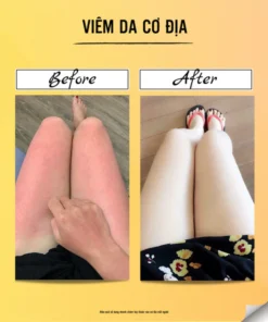 dalieu6