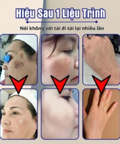 kemdoi3