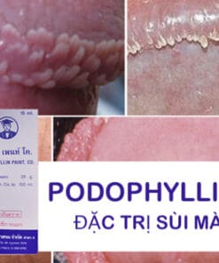 Thuốc Podophyllin 25 Thái Lan chữa trị sùi mào gà tại nhà cho nam nữ 4 podophyllin 25 thuoc