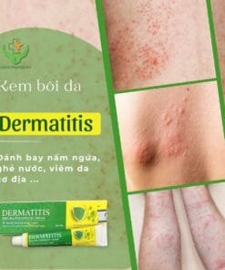 thanh phan Kem boi da tri nam ngua dermatitis thuy sy