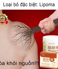 Kem loại bỏ u mỡ tan u mỡ Kem lipoma Loại bỏ mỡ dưới da 30g Tinh chất thảo mộc tự nhiên Giảm đau thần kinh gân khớp 11 tanmo1 1