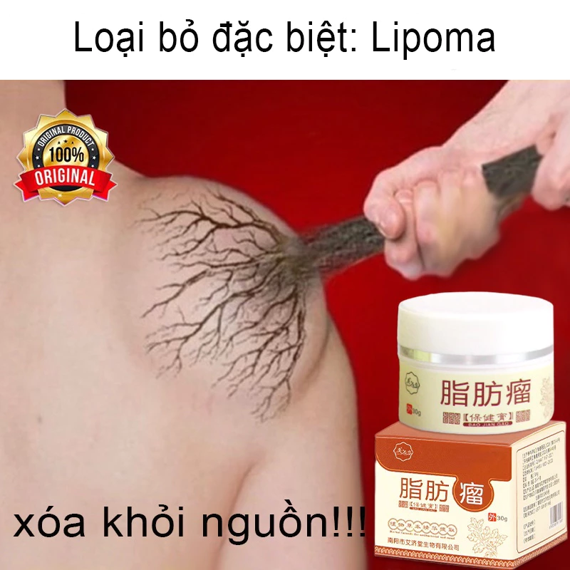 Kem loại bỏ u mỡ tan u mỡ Kem lipoma Loại bỏ mỡ dưới da 30g Tinh chất thảo mộc tự nhiên Giảm đau thần kinh gân khớp 28 tanmo1 1