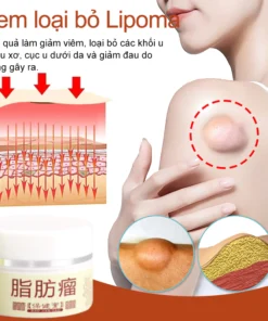Kem loại bỏ u mỡ tan u mỡ Kem lipoma Loại bỏ mỡ dưới da 30g Tinh chất thảo mộc tự nhiên Giảm đau thần kinh gân khớp 12 tanmo2