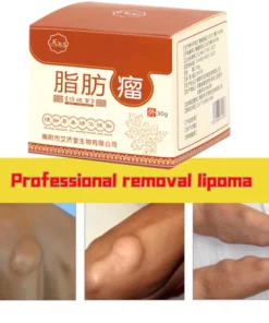 Kem loại bỏ u mỡ tan u mỡ Kem lipoma Loại bỏ mỡ dưới da 30g Tinh chất thảo mộc tự nhiên Giảm đau thần kinh gân khớp 18 tanmo8
