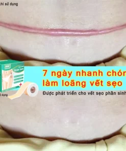 miếng dán sẹo Làm Mờ Sẹo Sau Phẫu Thuật Xóa Sạch Sẹo Thâm loại bỏ hiệu quả các vết sẹo lâu năm,vết thương,phỏng bô 11 danseo1