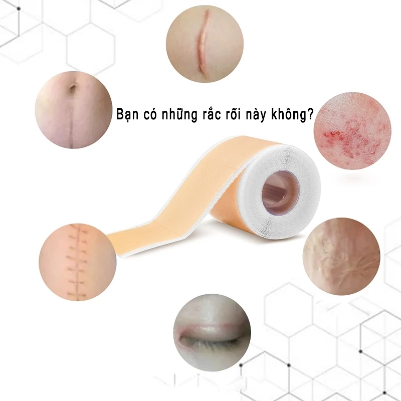 miếng dán sẹo Làm Mờ Sẹo Sau Phẫu Thuật Xóa Sạch Sẹo Thâm loại bỏ hiệu quả các vết sẹo lâu năm,vết thương,phỏng bô 10 miếng dán sẹo Làm Mờ Sẹo Sau Phẫu Thuật Xóa Sạch Sẹo Thâm loại bỏ hiệu quả các vết sẹo lâu năm,vết thương,phỏng bô - Ảnh 10