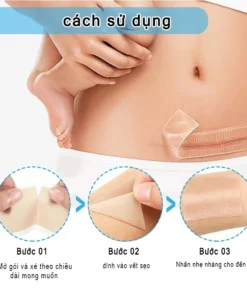 miếng dán sẹo Làm Mờ Sẹo Sau Phẫu Thuật Xóa Sạch Sẹo Thâm loại bỏ hiệu quả các vết sẹo lâu năm,vết thương,phỏng bô 12 danseo2