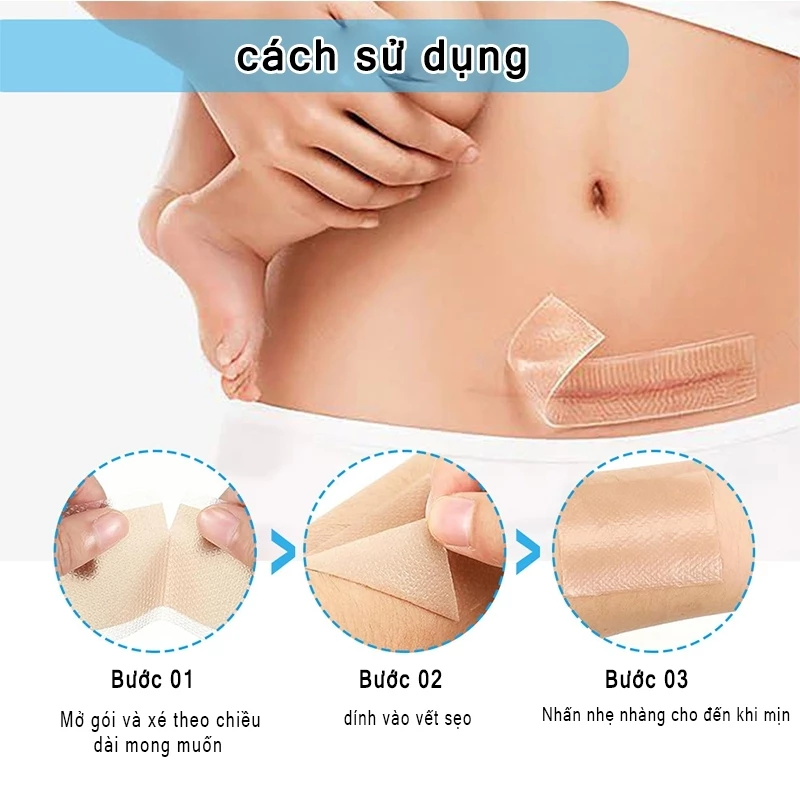 miếng dán sẹo Làm Mờ Sẹo Sau Phẫu Thuật Xóa Sạch Sẹo Thâm loại bỏ hiệu quả các vết sẹo lâu năm,vết thương,phỏng bô 3 miếng dán sẹo Làm Mờ Sẹo Sau Phẫu Thuật Xóa Sạch Sẹo Thâm loại bỏ hiệu quả các vết sẹo lâu năm,vết thương,phỏng bô - Ảnh 3