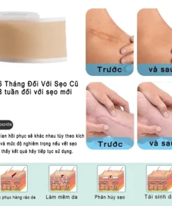 miếng dán sẹo Làm Mờ Sẹo Sau Phẫu Thuật Xóa Sạch Sẹo Thâm loại bỏ hiệu quả các vết sẹo lâu năm,vết thương,phỏng bô 15 danseo5