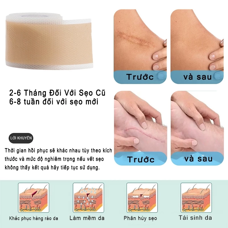 miếng dán sẹo Làm Mờ Sẹo Sau Phẫu Thuật Xóa Sạch Sẹo Thâm loại bỏ hiệu quả các vết sẹo lâu năm,vết thương,phỏng bô 6 miếng dán sẹo Làm Mờ Sẹo Sau Phẫu Thuật Xóa Sạch Sẹo Thâm loại bỏ hiệu quả các vết sẹo lâu năm,vết thương,phỏng bô - Ảnh 6