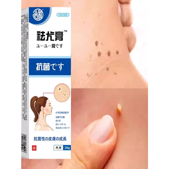 Kem bôi loại bỏ mụn thịt nhỏ trên cổ, da thừa, mụn cóc dạng sợi, mụn phẳng, mụn nhỏ ở vùng nách Nguyên liệu Nhật Bản 3 Kem bôi loại bỏ mụn thịt nhỏ trên cổ, da thừa, mụn cóc dạng sợi, mụn phẳng, mụn nhỏ ở vùng nách Nguyên liệu Nhật Bản - Ảnh 3