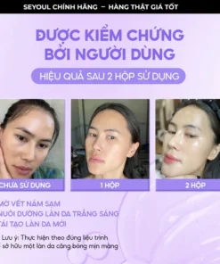 kemduongtrangda7