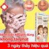 Kem lang ben kem kháng khuẩn loại bỏ bạch biến Dịu nhẹ Không kích ứng Thúc đẩy tăng trưởng hắc tố chăm sóc da 20g
