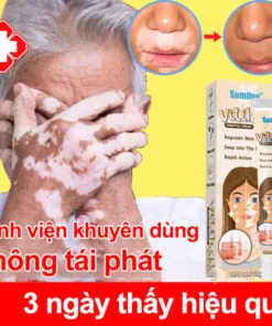 Kem lang ben kem kháng khuẩn loại bỏ bạch biến Dịu nhẹ Không kích ứng Thúc đẩy tăng trưởng hắc tố chăm sóc da 20g