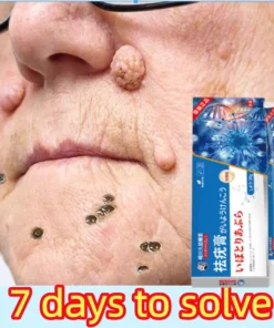 Kem mụn cóc Kem tẩy nốt ruồi mụn cóc Loại bỏ mụn cóc và mụn thịt vĩnh viễn An toàn Không đau 20g