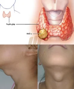 kemtuyengia7