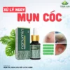 [MỤN CÓC] Tinh Chất Xử Lý Mụn Cóc, Mụn Cơm, Mắt Cá Nanumin 15ml
