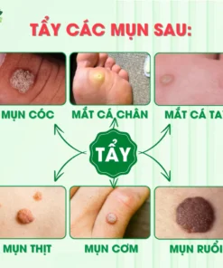 Tinh Chất Thảo Mộc NUNAMIN 15ML - Hỗ Trợ Xử Lý Mụn Cóc, Mụn Thịt, Mắt Cá Chân Tay 16 serumtaymun2
