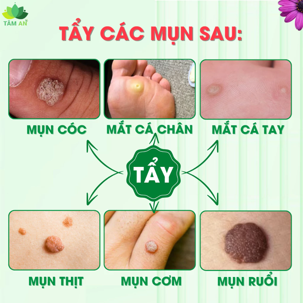 Tinh Chất Thảo Mộc NUNAMIN 15ML - Hỗ Trợ Xử Lý Mụn Cóc, Mụn Thịt, Mắt Cá Chân Tay 6 Tinh Chất Thảo Mộc NUNAMIN 15ML - Hỗ Trợ Xử Lý Mụn Cóc, Mụn Thịt, Mắt Cá Chân Tay - Ảnh 6