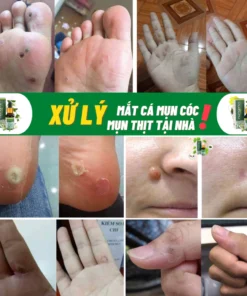Tinh Chất Thảo Mộc NUNAMIN 15ML - Hỗ Trợ Xử Lý Mụn Cóc, Mụn Thịt, Mắt Cá Chân Tay 14 serumtaymun5