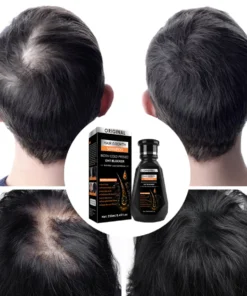 Dầu Gội Mọc Tóc Giảm Gàu, Dầu Thảo Dược Kích Thích Mọc Tóc, Nấm Ngứa, Bảo Vê Nang Tóc Chắc Khỏe Mượt - Ảnh 5