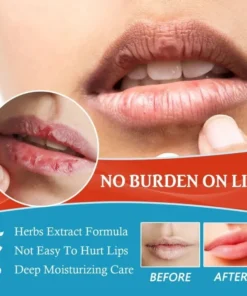 Kem mụn môi, Kem dưỡng môi hạt Sumifun - Son Dưỡng Môi Khô Nứt Nẻ, Bong tróc chăm sóc môi, Khử Thâm Môi 20gr - Ảnh 5