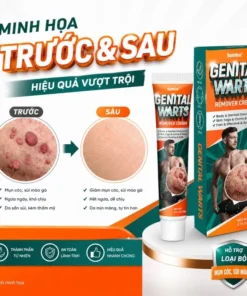 Kem bôi nam khoa Sumifun giúp giảm ngứa vùng kín làm sạch mụn cóc sùi mào gà 20g
