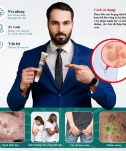 Kem bôi nam khoa Sumifun giúp giảm ngứa vùng kín làm sạch mụn cóc sùi mào gà 20g - Ảnh 3
