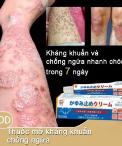 Kem Nhật Bản Bôi Nấm Kem Bôi Hắc Lào Thảo Dược, Phát Ban Tổ Đĩa - Ảnh 4