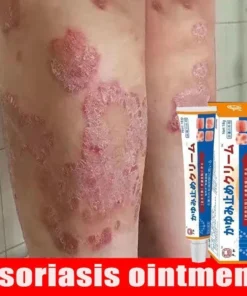 Kem Nhật Bản Bôi Nấm Kem Bôi Hắc Lào Thảo Dược, Phát Ban Tổ Đĩa - Ảnh 5
