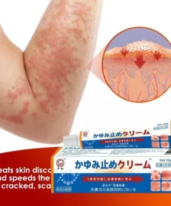 Kem Nhật Bản Bôi Nấm Kem Bôi Hắc Lào Thảo Dược, Phát Ban Tổ Đĩa - Ảnh 7
