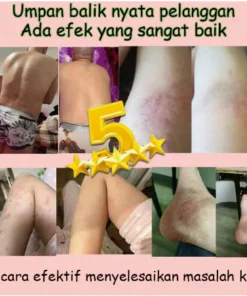 Kem Nhật Bản Bôi Nấm Kem Bôi Hắc Lào Thảo Dược, Phát Ban Tổ Đĩa - Ảnh 10