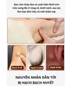 Kem tan hạch, bạch huyết Shixendo, dùng cho vùng cổ, nách, sau tai, làm tan u hạch, giảm sưng đỏ 10 Kem tan hạch, bạch huyết Shixendo, dùng cho vùng cổ, nách, sau tai, làm tan u hạch, giảm sưng đỏ - Ảnh 4