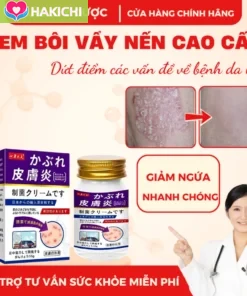 Kem Bôi Da Liễu NAKUSA 55g 🌿 Hỗ Trợ Chăm Sóc Da Ngứa, Da Khô, Da Nứt Nẻ – Công Thức Nhật Bản - Ảnh 2