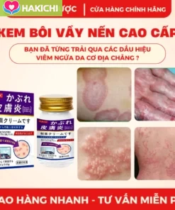 Kem Bôi Da Liễu NAKUSA 55g 🌿 Hỗ Trợ Chăm Sóc Da Ngứa, Da Khô, Da Nứt Nẻ – Công Thức Nhật Bản