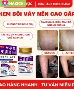Kem Bôi Da Liễu NAKUSA 55g 🌿 Hỗ Trợ Chăm Sóc Da Ngứa, Da Khô, Da Nứt Nẻ – Công Thức Nhật Bản - Ảnh 4