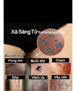 Kem kháng khuẩn bôi da Pacify Xà Sàng Tử (loại 18g) giảm ngứa viêm da - Ảnh 6
