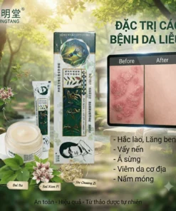 Xanh La )) Kem bôi á sừng, nấm ngứa ngoài da 15gr
