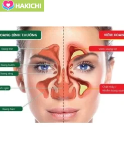 Xịt xoang mũi, nghẹt mũi dị ứng, chảy nước mũi do thời tiết JIMINGTANG 24ML NỘI ĐỊA Trung 12 Xịt xoang mũi, nghẹt mũi dị ứng, chảy nước mũi do thời tiết JIMINGTANG 24ML NỘI ĐỊA Trung - Ảnh 3
