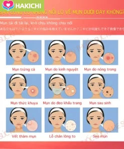 Gel chính hãng, dùng cho viêm nang lông, mụn ẩn, mụn trứng cá, kháng khuẩn giảm ngứa, phục hồi da, lành tính không gây kích ứng, giảm mụn đỏ sưng, mụn trứng cá viêm và mụn mủ. - Ảnh 4