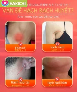 【Kem bôi hạch bạch huyết 】 Giúp giảm sưng hạch bạch huyết ở cổ, tiêu phù nề, hỗ trợ tan hạch vùng nách, nách và cổ, thông kinh lạc, hỗ trợ làm mềm và tiêu các khối hạch. - Ảnh 4