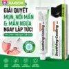 Kem điều trị bệnh trĩ chính hãng, giảm sưng đau vùng hậu môn, tiêu sưng, cầm máu và làm co búi trĩ, dùng cho cả nam