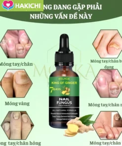 TINH CHẤT LOẠI BỎ NẤM MÓNG GINGER EELHOE 7 NGÀY - NẤM MÓNG LÂU NĂM CŨNG HẾT, CAM KẾT KHÔNG TÁI LẠI - Ảnh 2