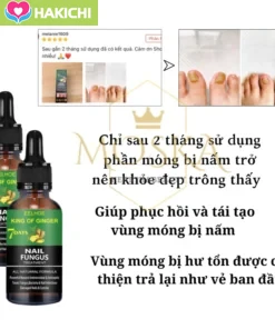 TINH CHẤT LOẠI BỎ NẤM MÓNG GINGER EELHOE 7 NGÀY - NẤM MÓNG LÂU NĂM CŨNG HẾT, CAM KẾT KHÔNG TÁI LẠI - Ảnh 5