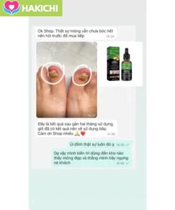 TINH CHẤT LOẠI BỎ NẤM MÓNG GINGER EELHOE 7 NGÀY - NẤM MÓNG LÂU NĂM CŨNG HẾT, CAM KẾT KHÔNG TÁI LẠI - Ảnh 6