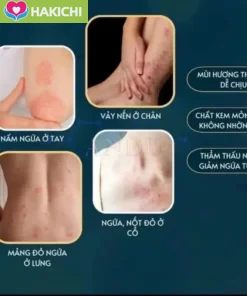 Combo 3 Tuýp Kem Bôi Da Liễu Nhật Bản 15gam Bôi Nấm Ngứa Hắc Lào Vẩy Nến Á Sừng Tổ Đỉa Ghẻ Nước - Ảnh 8